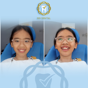 6 Cách chăm sóc vô cùng hữu hiệu bậc phụ huynh nên xem dành cho răng miệng trẻ em