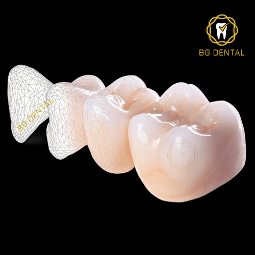 Làm răng ở đâu tốt tại TPHCM